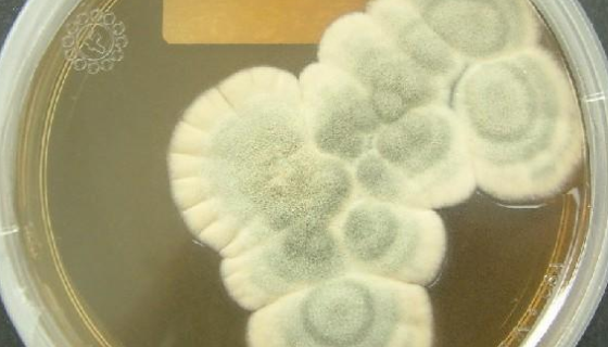 桔青霉的保藏条件与注意事项及打管说明！