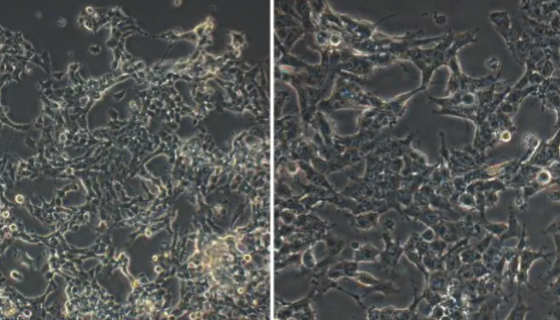 Kelly人神经母细胞瘤细胞的培养方式与质量检测！