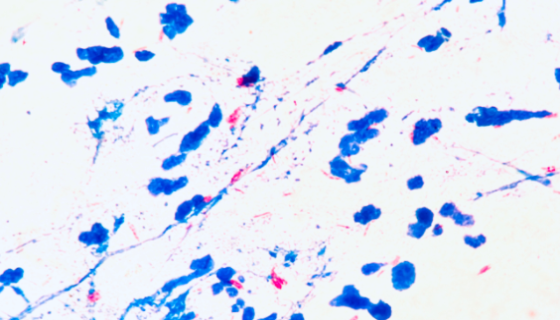 ATCC 19622 地分枝杆菌的复壮方法与操作流程！