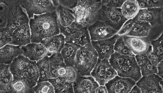 小鼠胚胎肝细胞的培养步骤与应用！