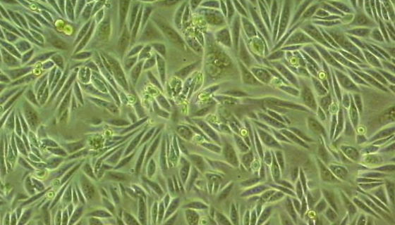 人类风湿关节炎滑膜成纤维细胞的应用！