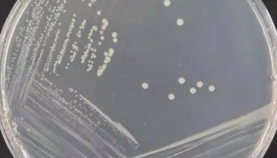 恶臭假单胞菌（带绿色荧光）的活化表达方法！