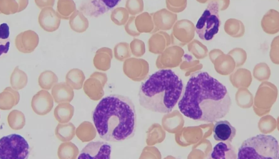 THP-1细胞的常规培养步骤及应用！