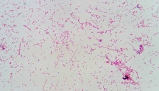 ATCC 27768 普拉梭菌；普氏粪杆菌