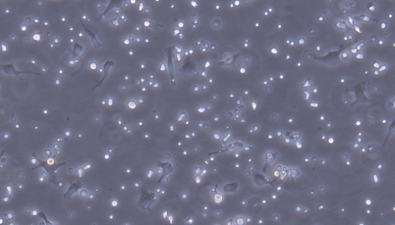 小鼠鳞状细胞癌细胞收到后的处理方法与培养步骤！