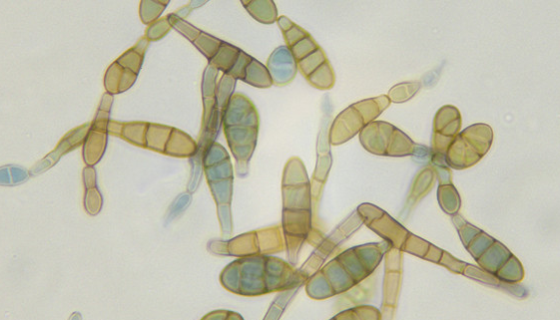 暗孢节菱孢菌——为该病防治提供依据