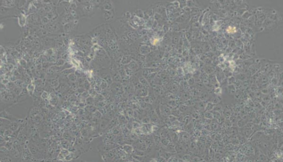 人胎盘绒毛膜细胞的背景与应用及传代步骤！