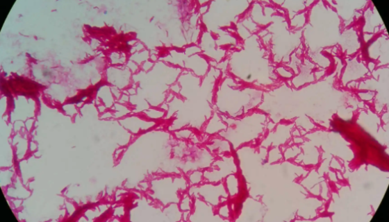 ATCC 12478 堪萨斯分枝杆菌的知识解析！