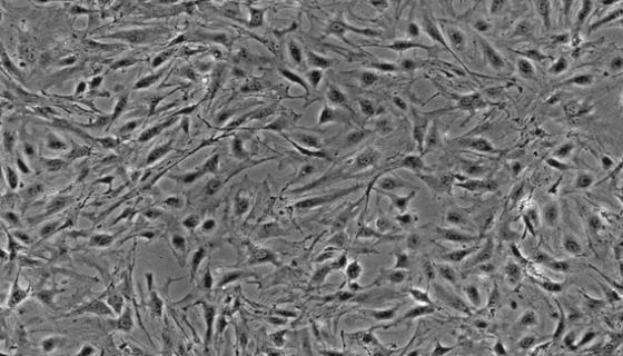 大鼠胰腺星状细胞的背景与应用！