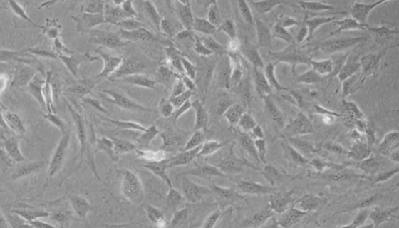 人支气管上皮细胞的培养方法与注意事项！