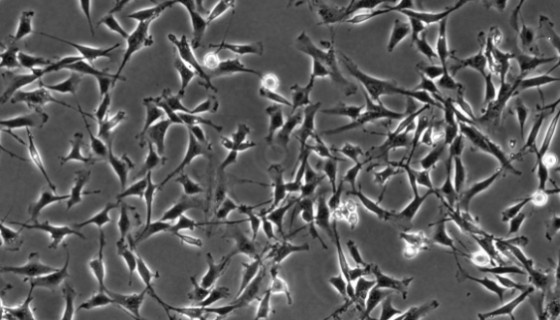 牛主动脉内皮细胞的复苏与传代及冻存操作说明！
