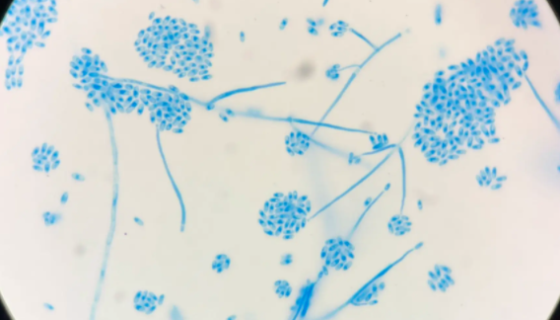短柄帚霉——电工电子产品试验菌