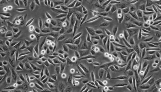 兔肝鳞癌肿瘤细胞收到后处理方法与培养步骤！