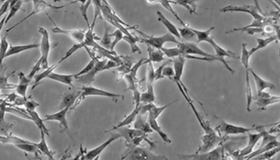 ONS-76人脑髓母瘤细胞的培养方法与注意事项！