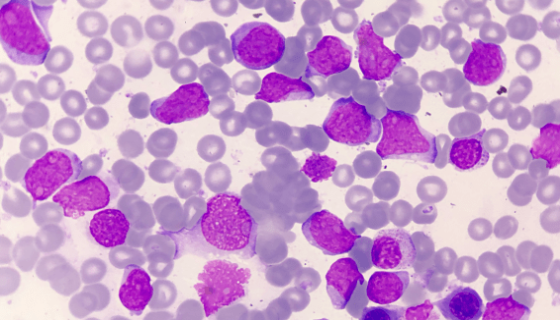 细胞淋巴瘤细胞的性质与用途及生产工艺！