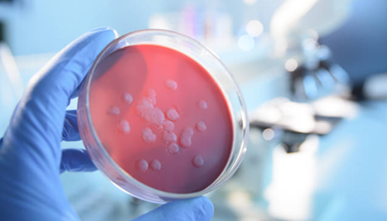 对药品微生物检验所用培养基的研究！