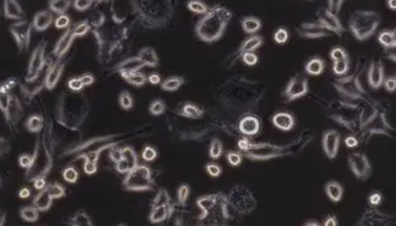 小鼠逆转录病毒包装株的处理方法与培养步骤！