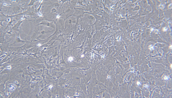 猫星形脑胶质细胞的培养操作步骤及注意事项！