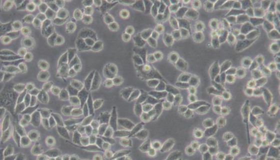 小鼠皮下结缔组织细胞的处理方法与培养步骤！