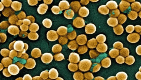 粘着剑菌——用于植物冠瘿病害和遗传转化材料