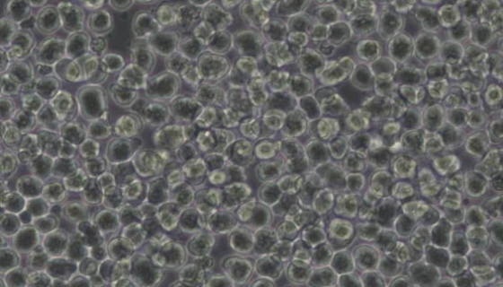 NB2-11大鼠淋巴瘤细胞的质量检测与培养方式！