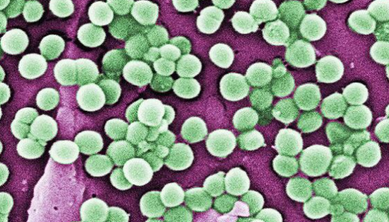 DSM 3318 马泽氏甲烷八叠球菌 百欧博伟生物