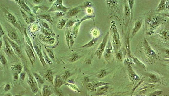 HLF-A人肺上皮细胞的复苏与传代及冻存操作说明！