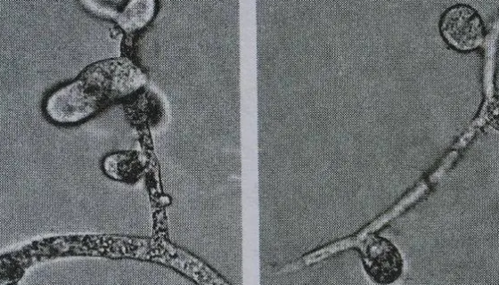 瓜果腐霉的形态特征与主要分布及真菌特点！