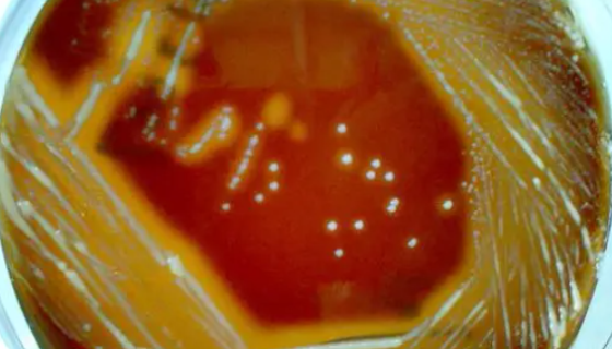 ATCC 49753 贪婪丙酸杆菌知识概述及培养与保藏！