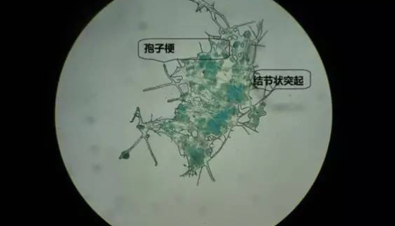 ATCC MYA-2338 辣椒疫霉菌 百欧博伟生物