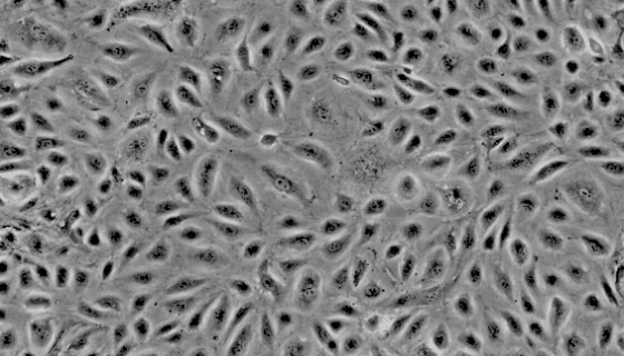 HRMECs永生化人视网膜微血管内皮细胞的培养步骤！