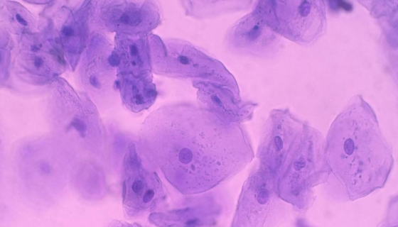 人口腔角质细胞的背景与应用及研究动态！