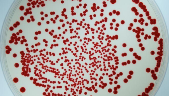 青枯雷尔氏菌的培养方法及冻干管打管说明！