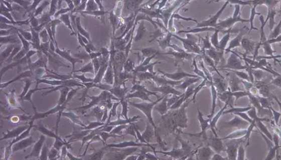 HC11小鼠乳腺上皮细胞的处理方法与培养步骤！