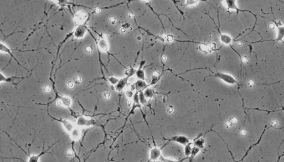 RHNC大鼠海马神经元细胞的培养步骤与操作说明！
