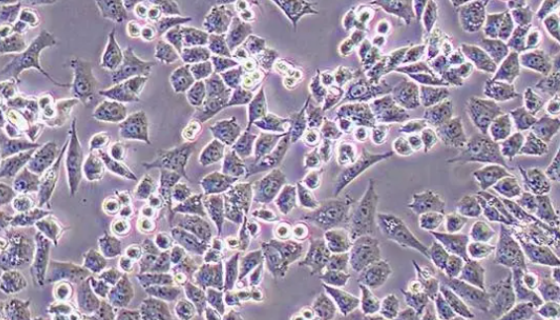 HEY人卵巢癌细胞的培养步骤与常见问题及解决方案！