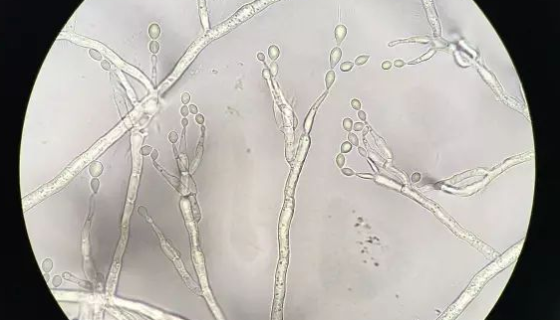 出芽短梗霉菌的优势特点与功能功效及打管说明！