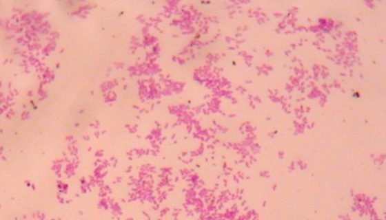 牛布鲁氏菌病的病原特点与临床症状及防治措施！