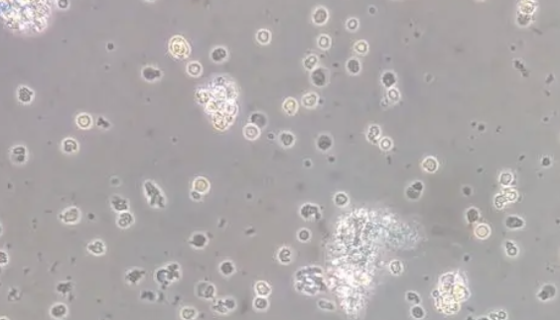 人外周血单核细胞的性质与用途及生产工艺！