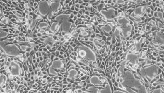 BT-474人乳腺导管癌细胞的处理方法与培养步骤！