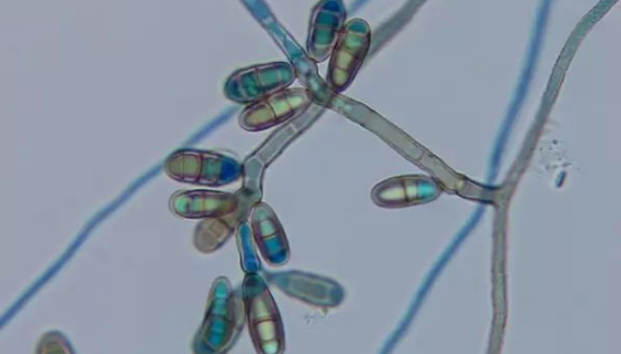 德尔布有孢圆酵母的性质与用途及生产工艺！