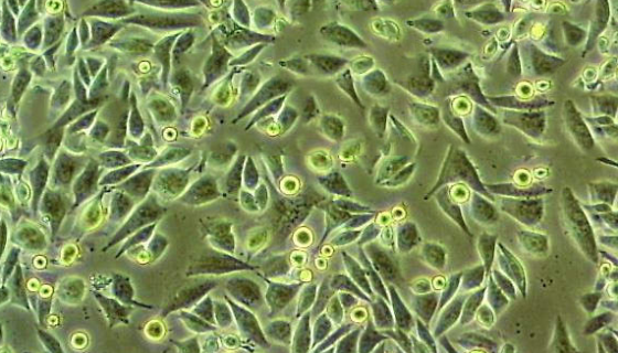 A101D 人黑色素瘤细胞的培养方式与质量检测！