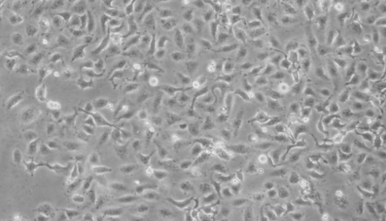 KU-19-19人膀胱癌细胞的质量检测及培养方法！