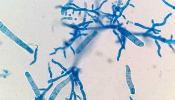 螺卷毛壳——用于生产毛壳菌素和防治镰刀菌