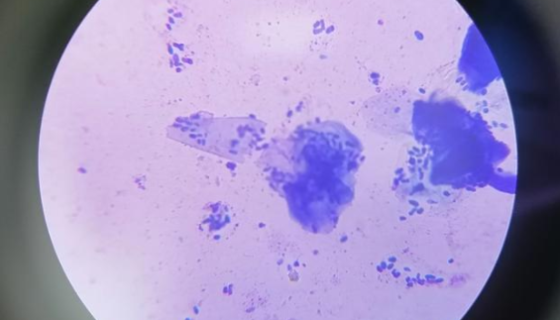 马拉色菌病的发病原因与临床表现及防治方法！