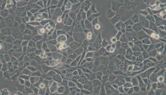 大鼠肺泡上皮细胞系的培养方式与质量检测！