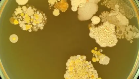 检验技术分享：食品加工过程中卫生控制！