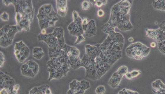 Beta-TC-6（小鼠胰岛素瘤胰岛β细胞）的应用！