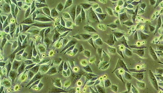 HuCCT1人胆管癌细胞的处理方法与培养步骤！