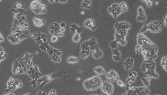 PLC/PRF/5（人肝癌亚力山大细胞）的培养与应用！